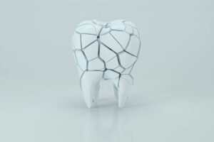 concept image of 3d cracked tooth