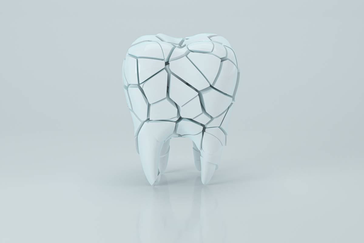 concept image of 3d cracked tooth