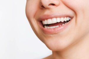 featured image for do dental veneers require a lot of maintenance