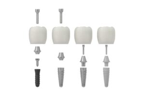 Featured image for What Are the Different Types of Dental Implants