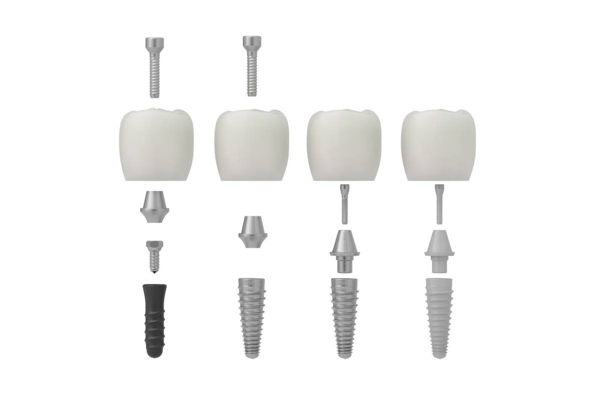 Featured image for What Are the Different Types of Dental Implants